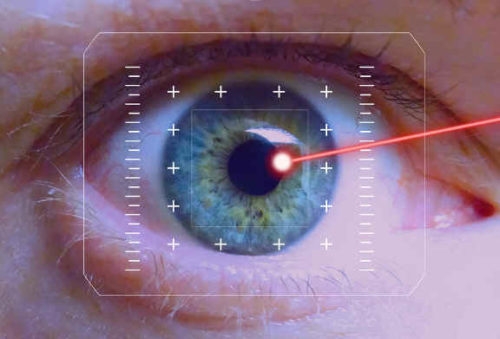 eye medical laser
